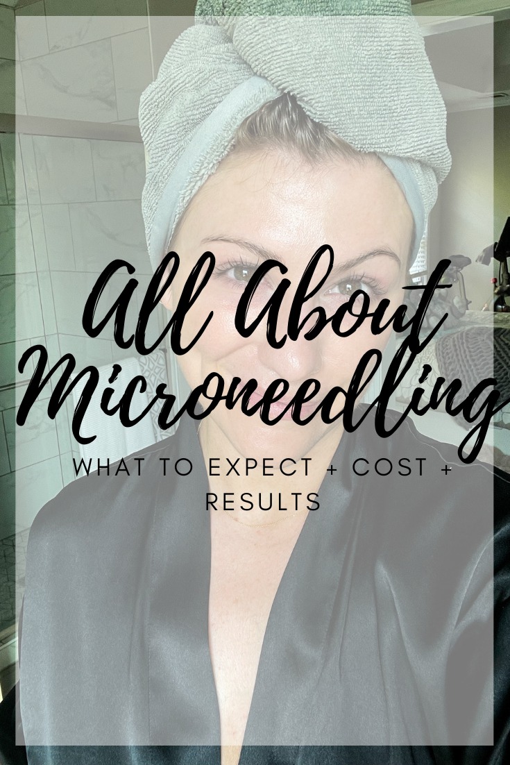 Everything You Need to Know About Microneedling. | Le Stylo Rouge