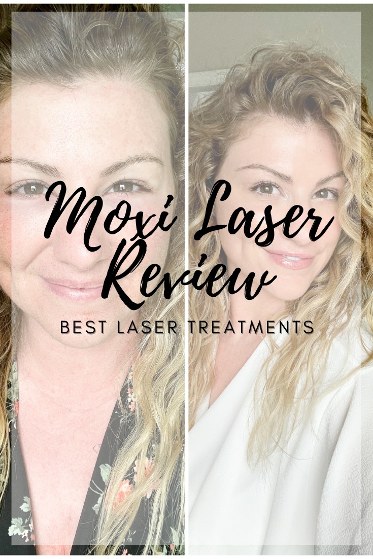Sharing My Moxi Laser Experience. | LSR